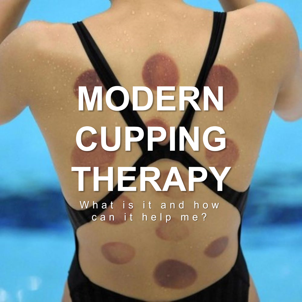 Cupping